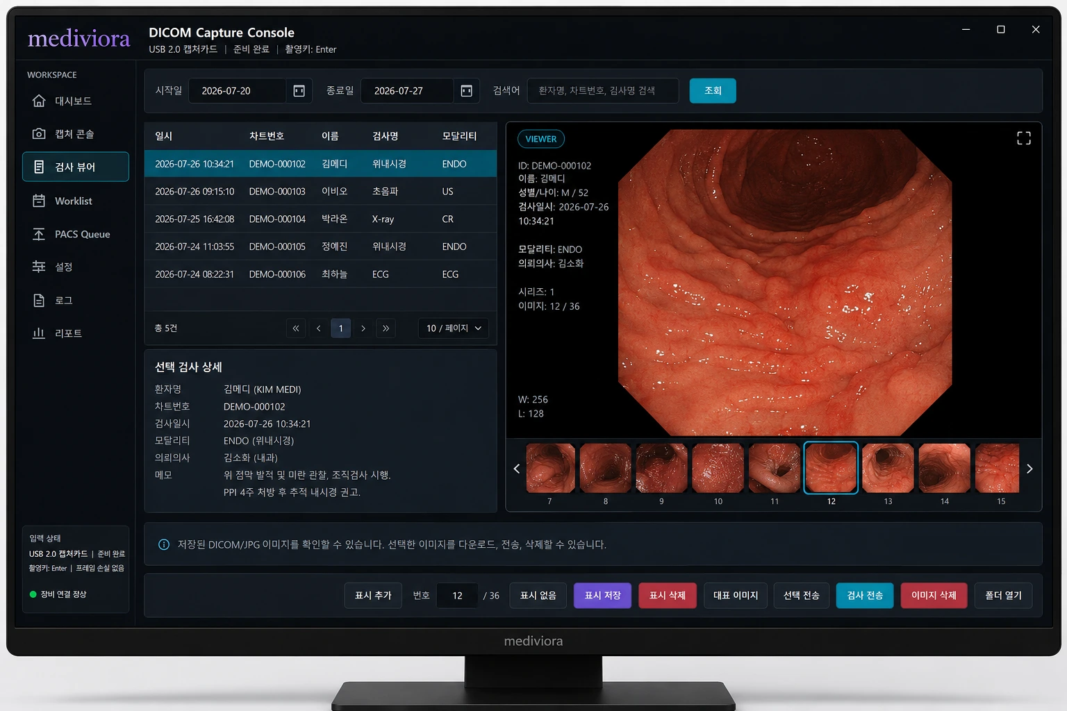 검사 뷰어