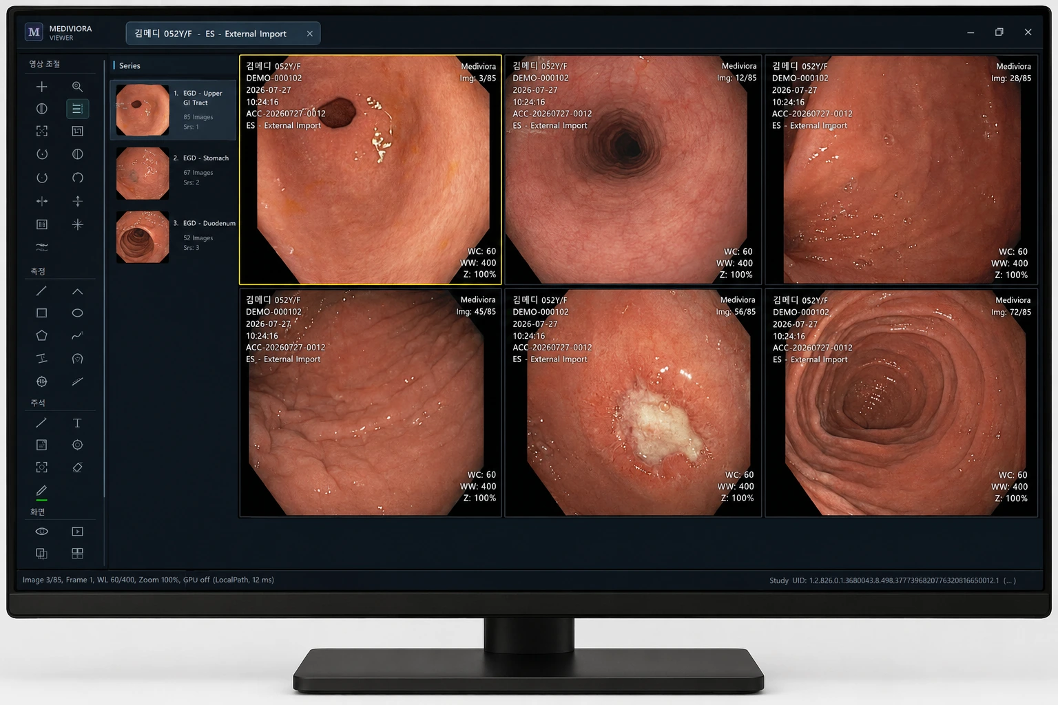 기존 메디비오라 PACS Viewer 시연 자료, 가상 환자 데이터